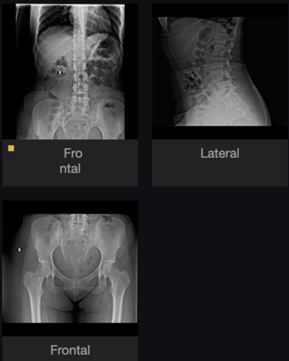 <p>Findings?</p>