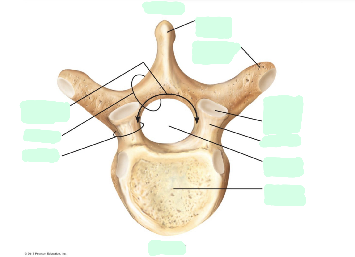 <p>Where is the <strong>Vertebral Foramina (foramen) </strong>of the thoracic vertebrae?</p>