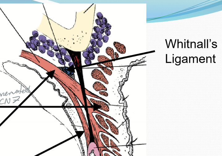<p>Whitnall’s Ligament</p>
