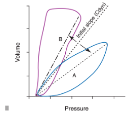 <p>What do these loops indicate?</p>