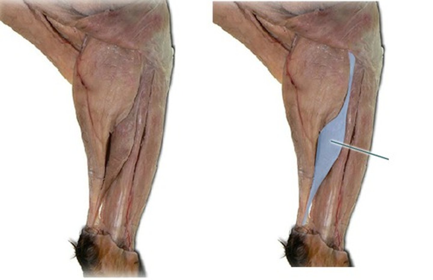 <p>Origin: Proximal end of Fibula</p><p>Insertion: Calcacenous</p><p>Action: Extend foot</p>