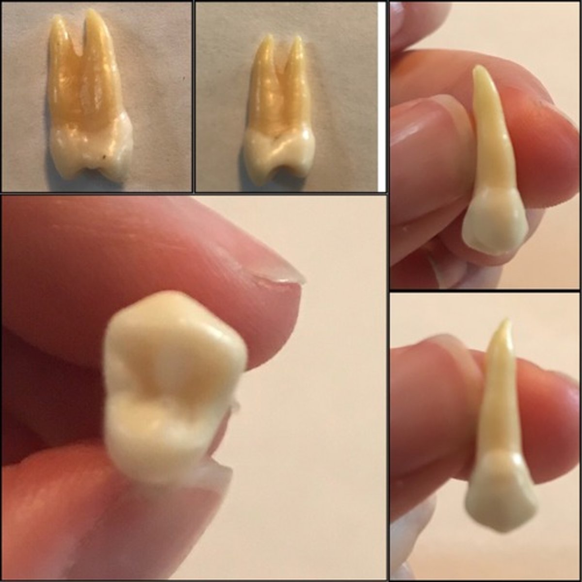 <p>What tooth is this ?</p>