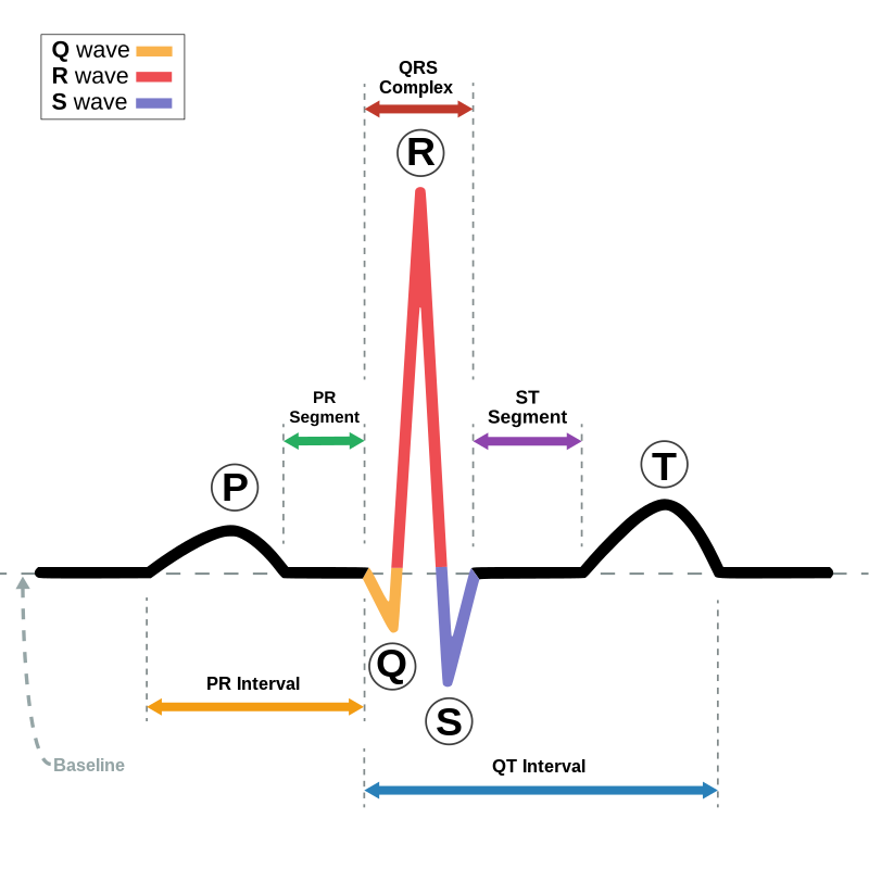 <p>Main part of the graph. </p><p>Produced by the depolarisation of ventricular contractile fibres. </p>