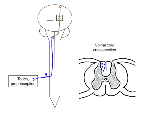 <ul><li><p>carries information on fine touch, pressure, conscious proprioception</p></li><li><p>medial lemniscal pathway (3 neurons)</p><ul><li><p>primary neuron</p></li><li><p>secondary neuron</p></li><li><p>tertiary neuron</p></li></ul></li></ul><p></p>