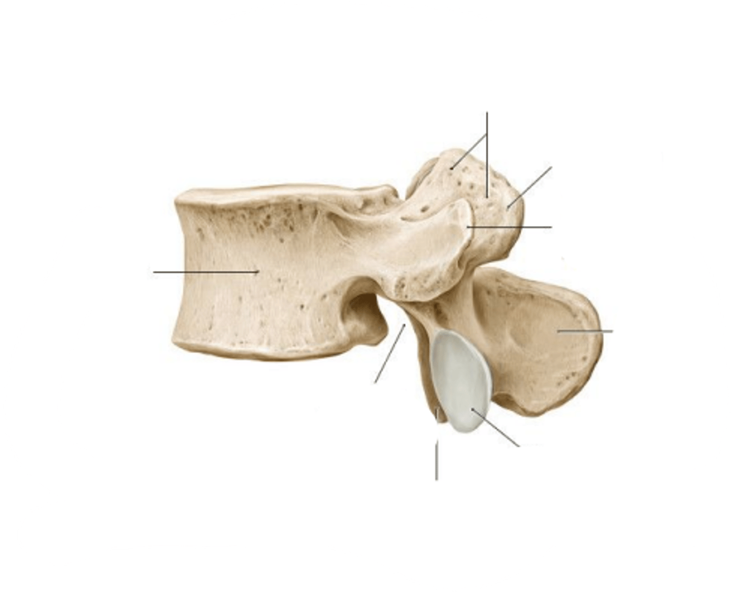 <p>What type of vertebra is shown?</p>