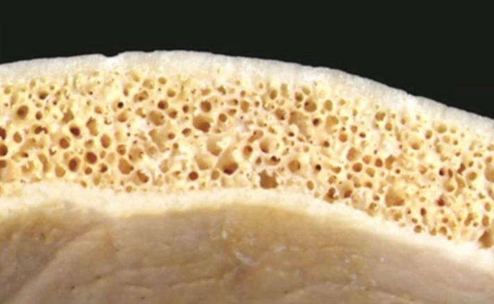 <ul><li><p>Top and bottom layer of compact bone; covered with periosteum.</p></li><li><p>Middle layer of spongy bone (continuous with compact bone); covered with endosteum.</p></li></ul><p></p>