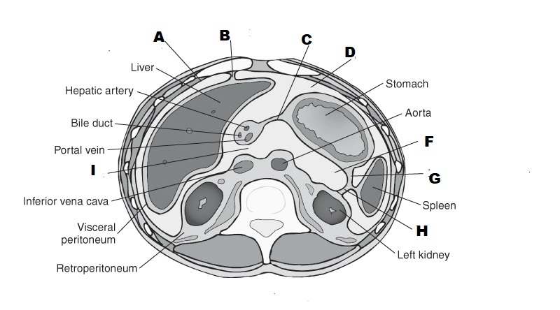 <p>A</p>