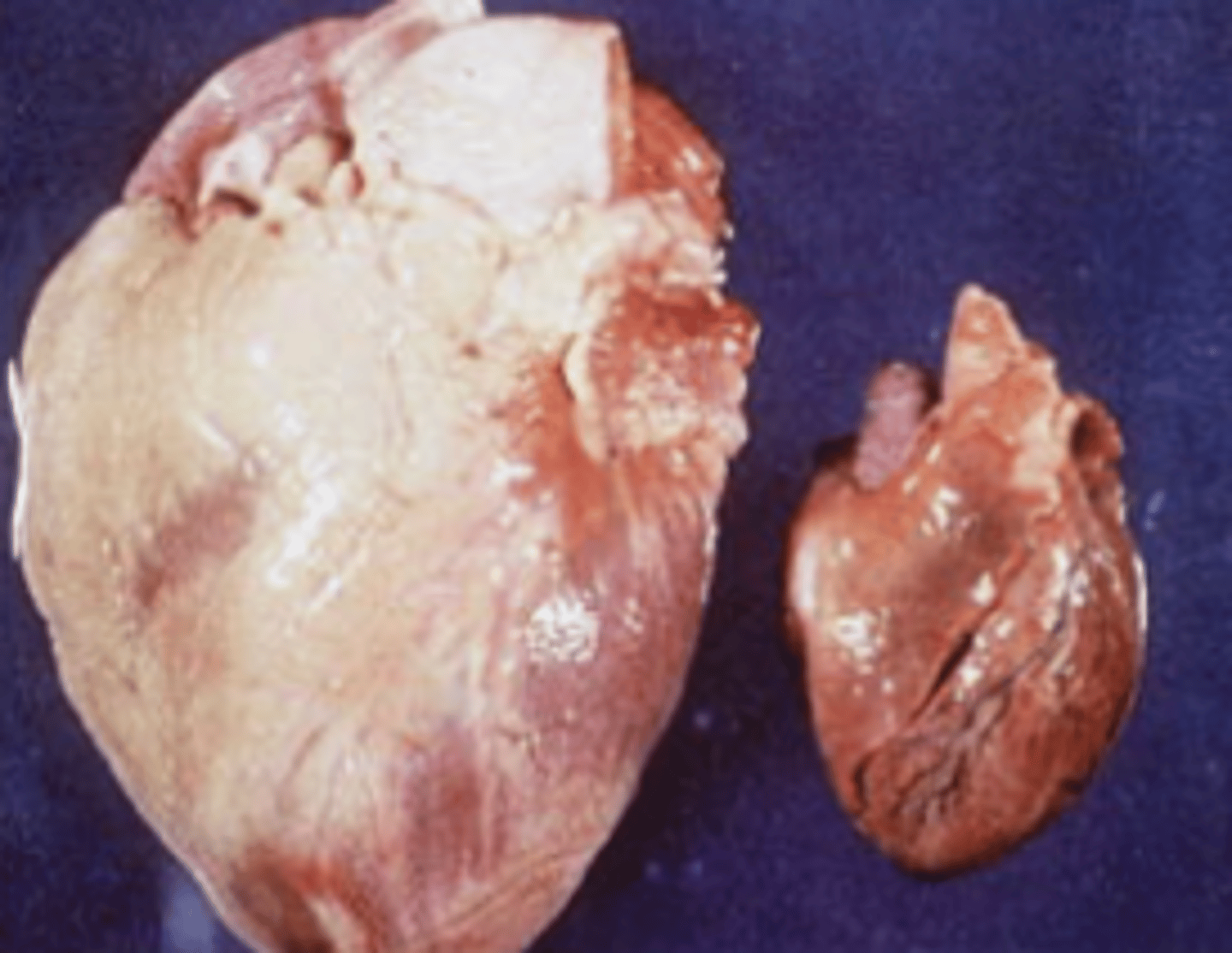 <p>What type of cellular adaptation is shown in this photo?</p>