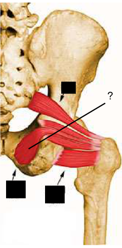 <p>Nom et caractéristiques de cette structure ?</p>