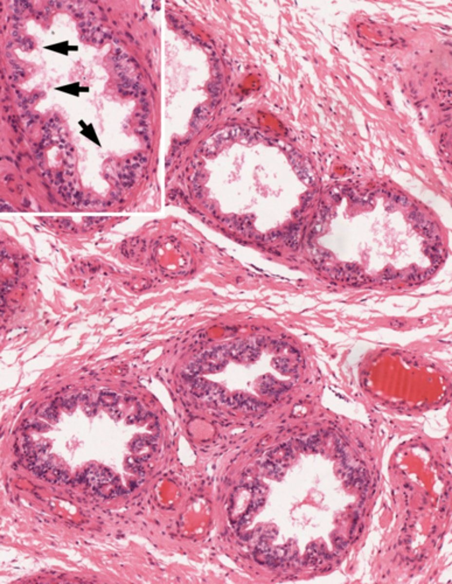 <p>What kind of epithelium is found here (and all ducts from here to prostatic urethra are of this type)? </p>