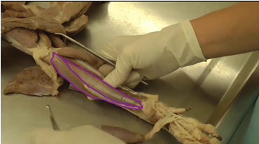 <p><span>Antebrachial Region (Forearm)</span></p>