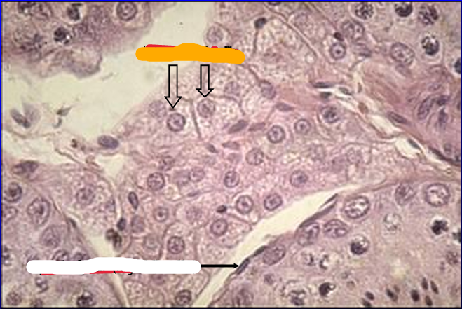 <p>Identify the structure:</p><p>Specie:</p><p>Orange:</p><p>White:</p>