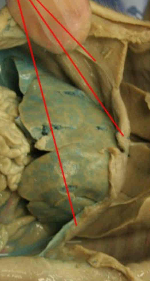 <p>Identify this structure</p>