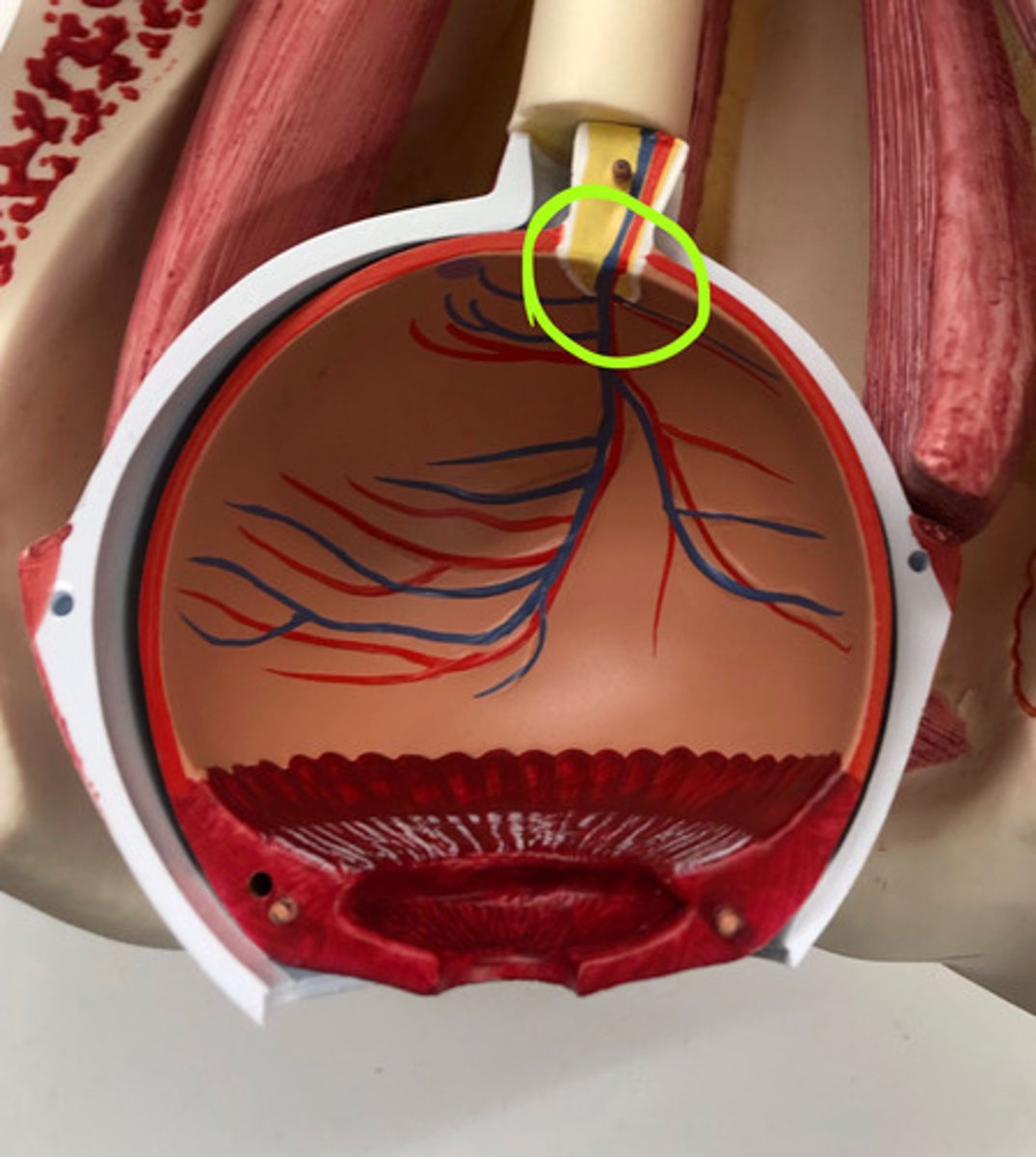 <p>where the optic nerve comes into the eye</p>