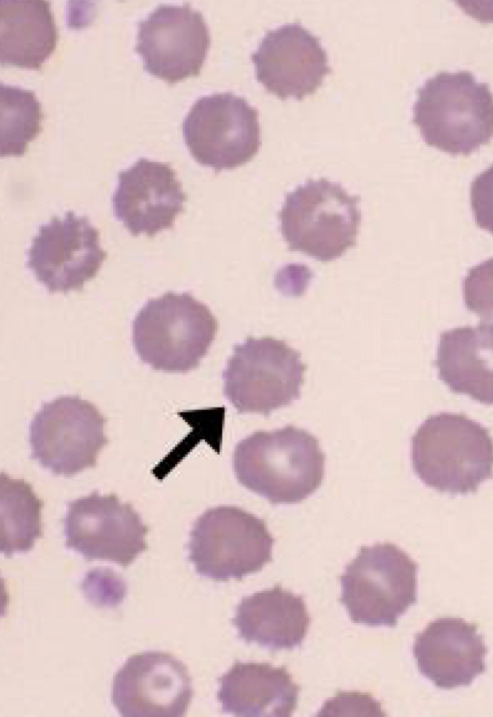 Name this RBC Abnormality.