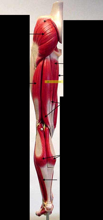 <p>What muscle is this?*****</p>