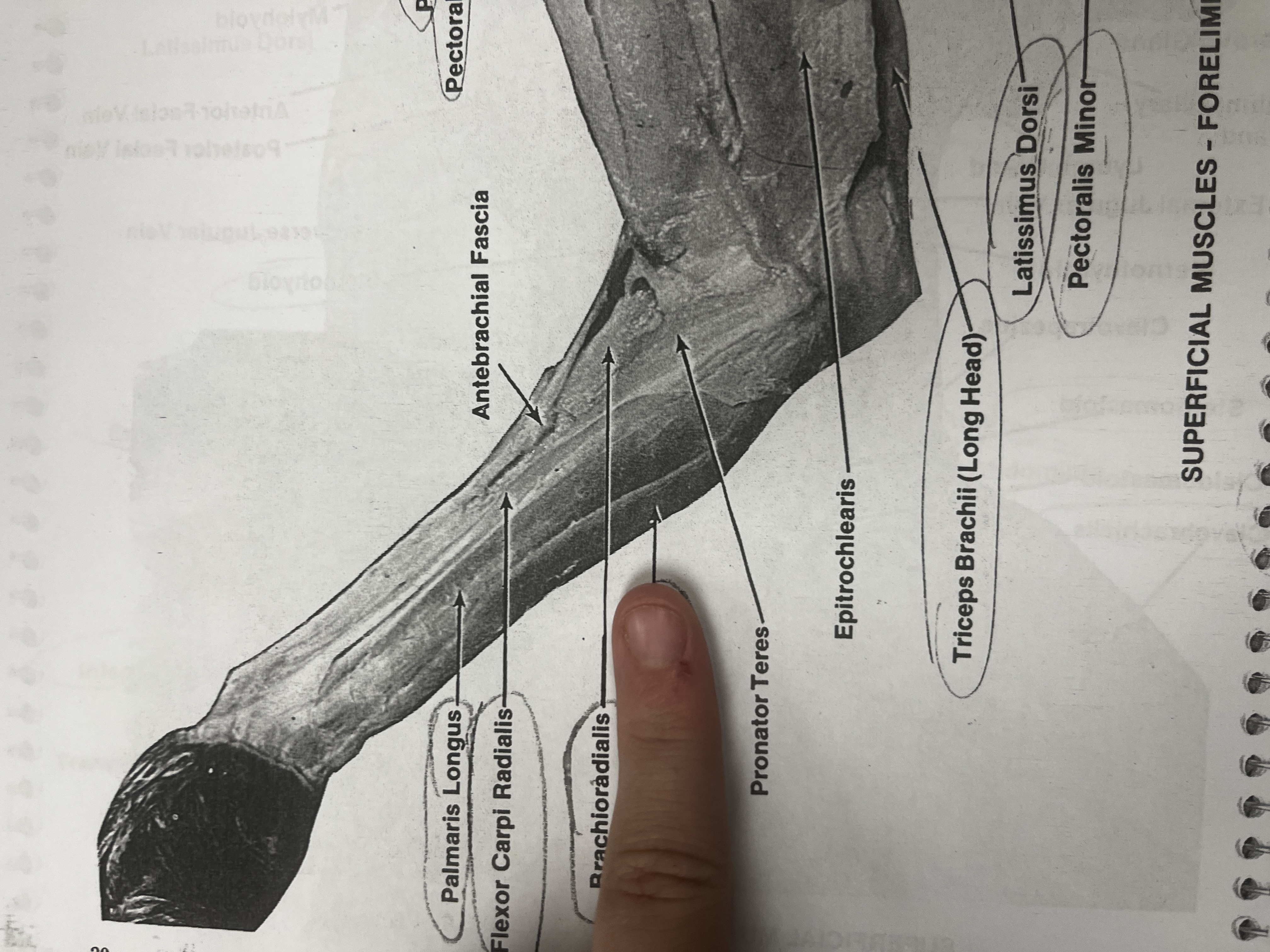 <p>A muscle that flexes and adducts the wrist.</p>