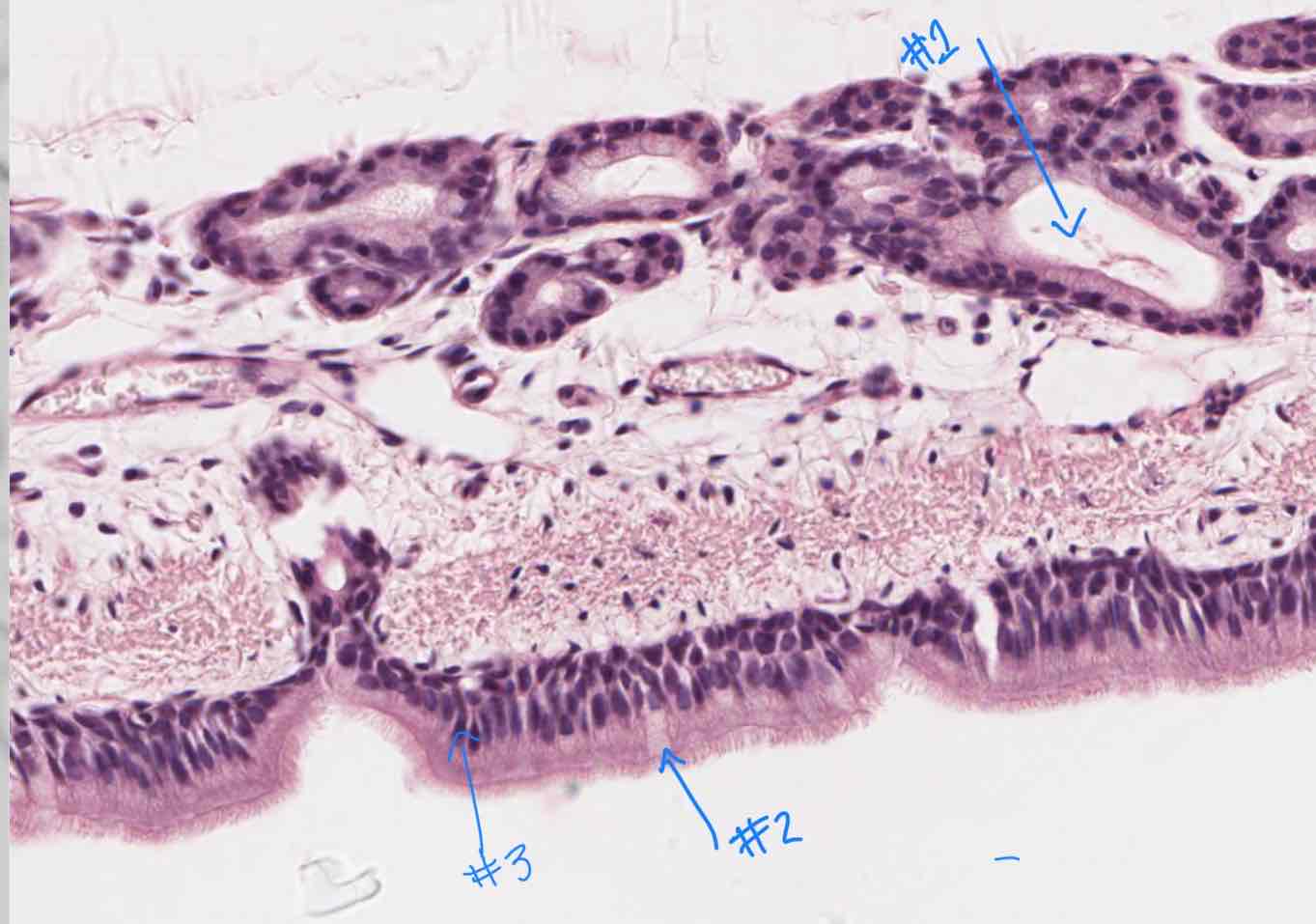 <p>What cell type is #2 referring to?</p>