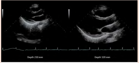 <p>What is the optimal 'Depth of view' for a 2D echo image?</p>