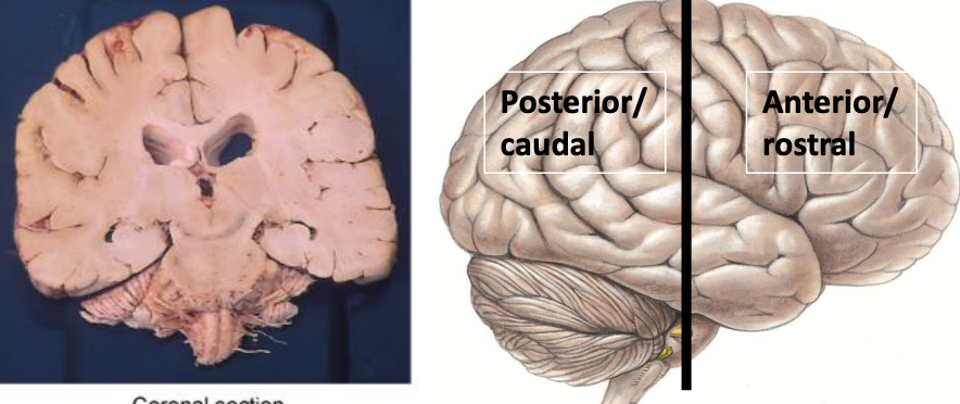 <p>cuts brain into anterior and posterior sections</p>