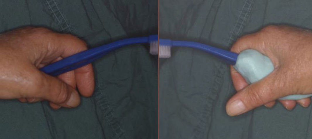 <ul><li><p>silicone putty can be added to handle to give the patient a better grip</p></li></ul><p></p>