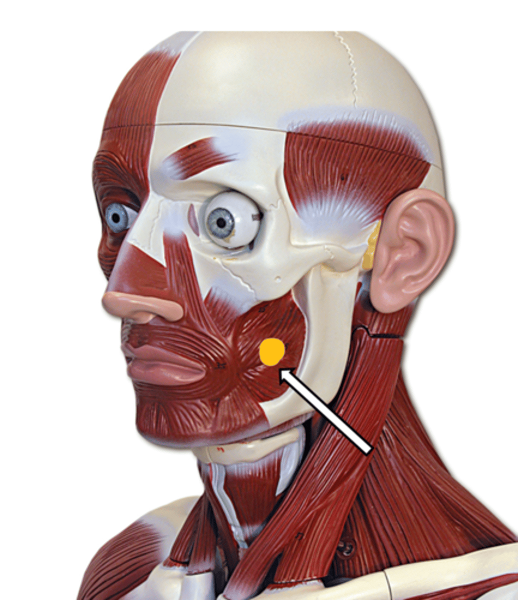 <p>name the muscle</p>