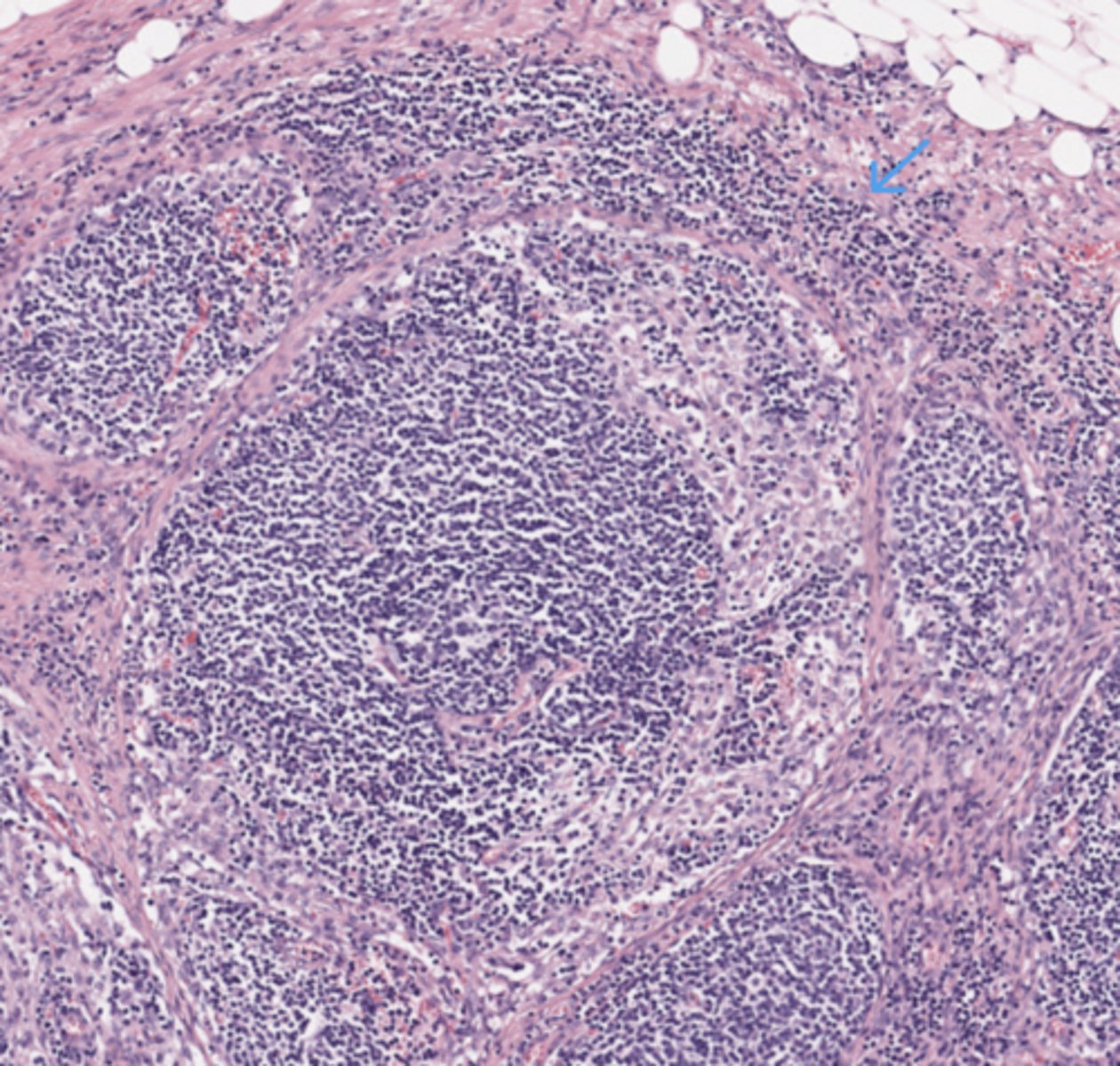 <p>Pancreas</p>