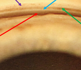 <p>identify the blue arrow structure</p>