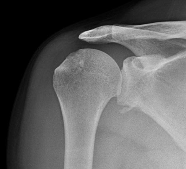 <p>Describe the abnormality demonstrated.</p>