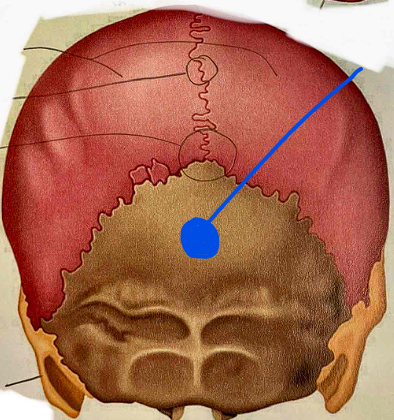 <p>Name the bone</p>