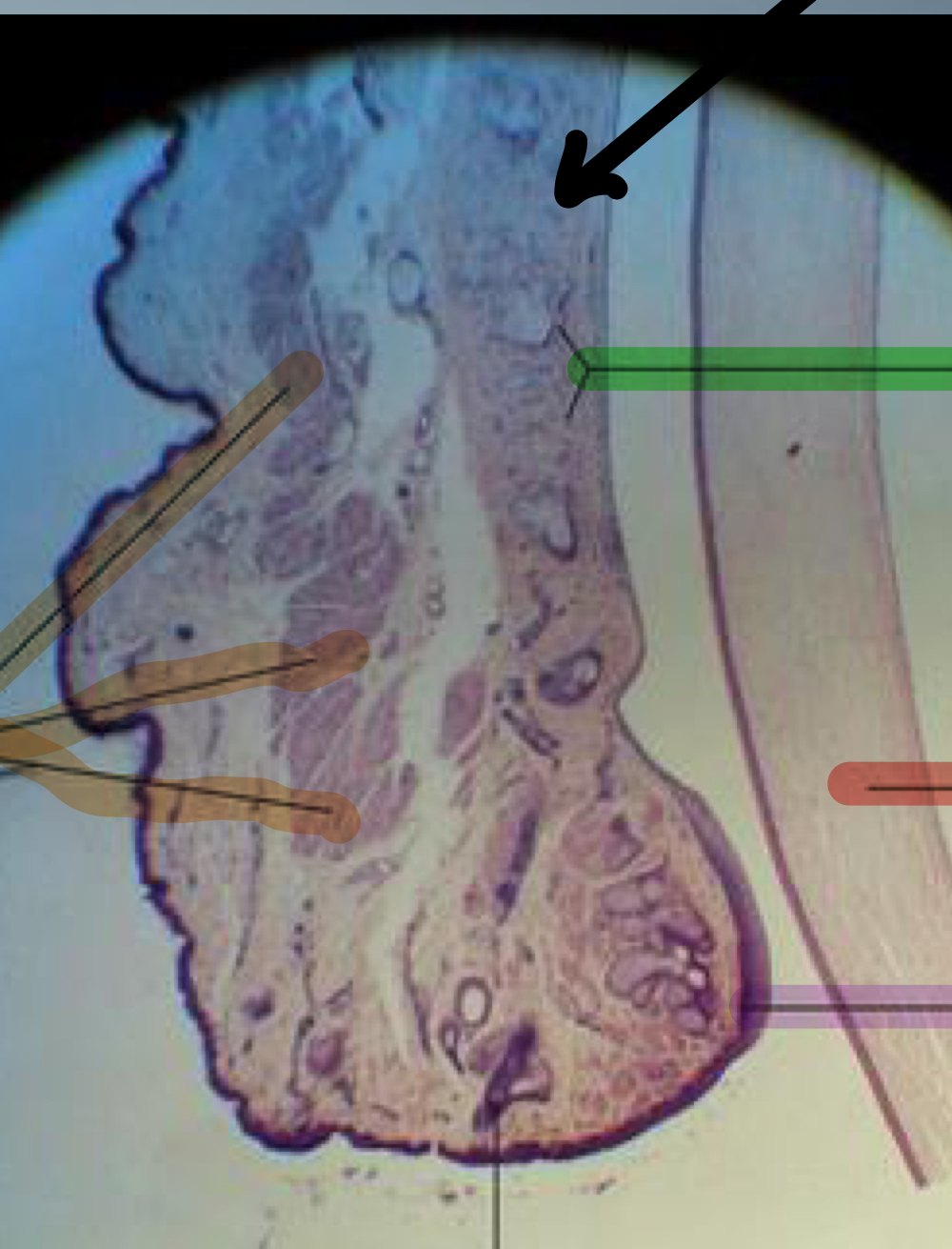 In the slide image of the eyelid, what structure is indicated by the red arrow?