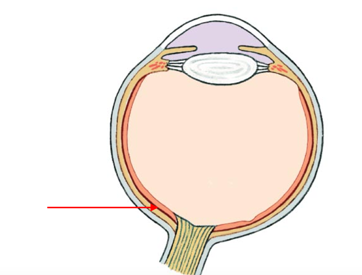 term image