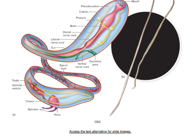 <p>pathogenic roundworm:</p>