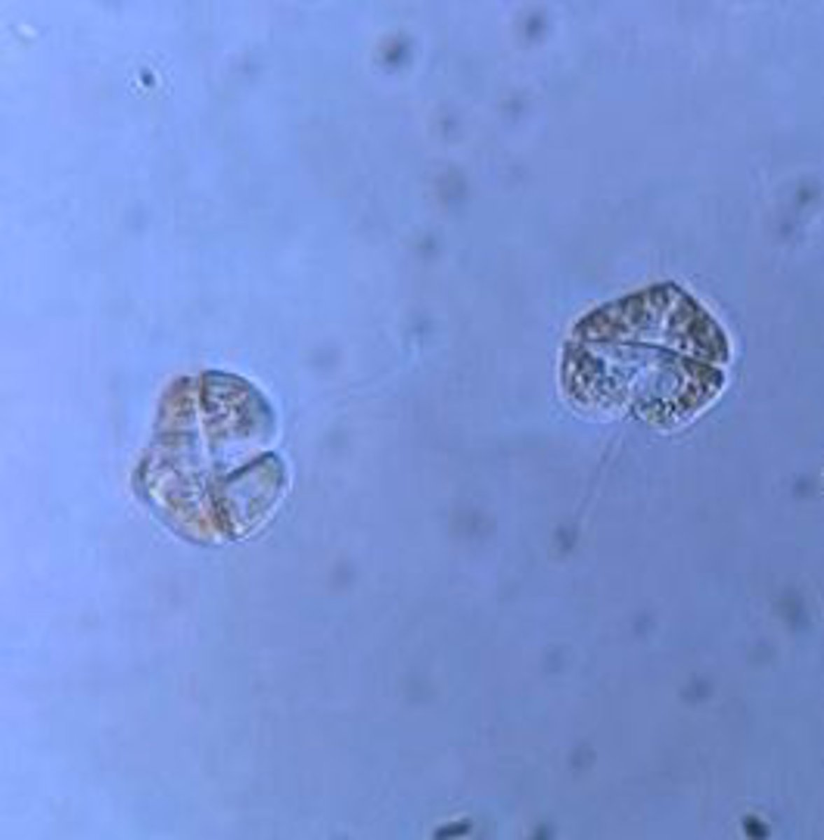 <p>Identify the marine dinoflagellate shown, responsible for the toxic "red tide" in the Gulf of Mexico.</p>