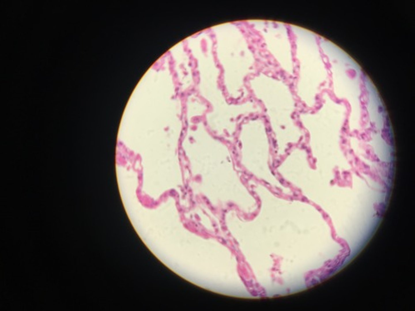 <p>simple squamous </p>