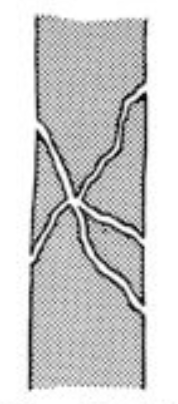 <p>What classification of fracture is this?</p>