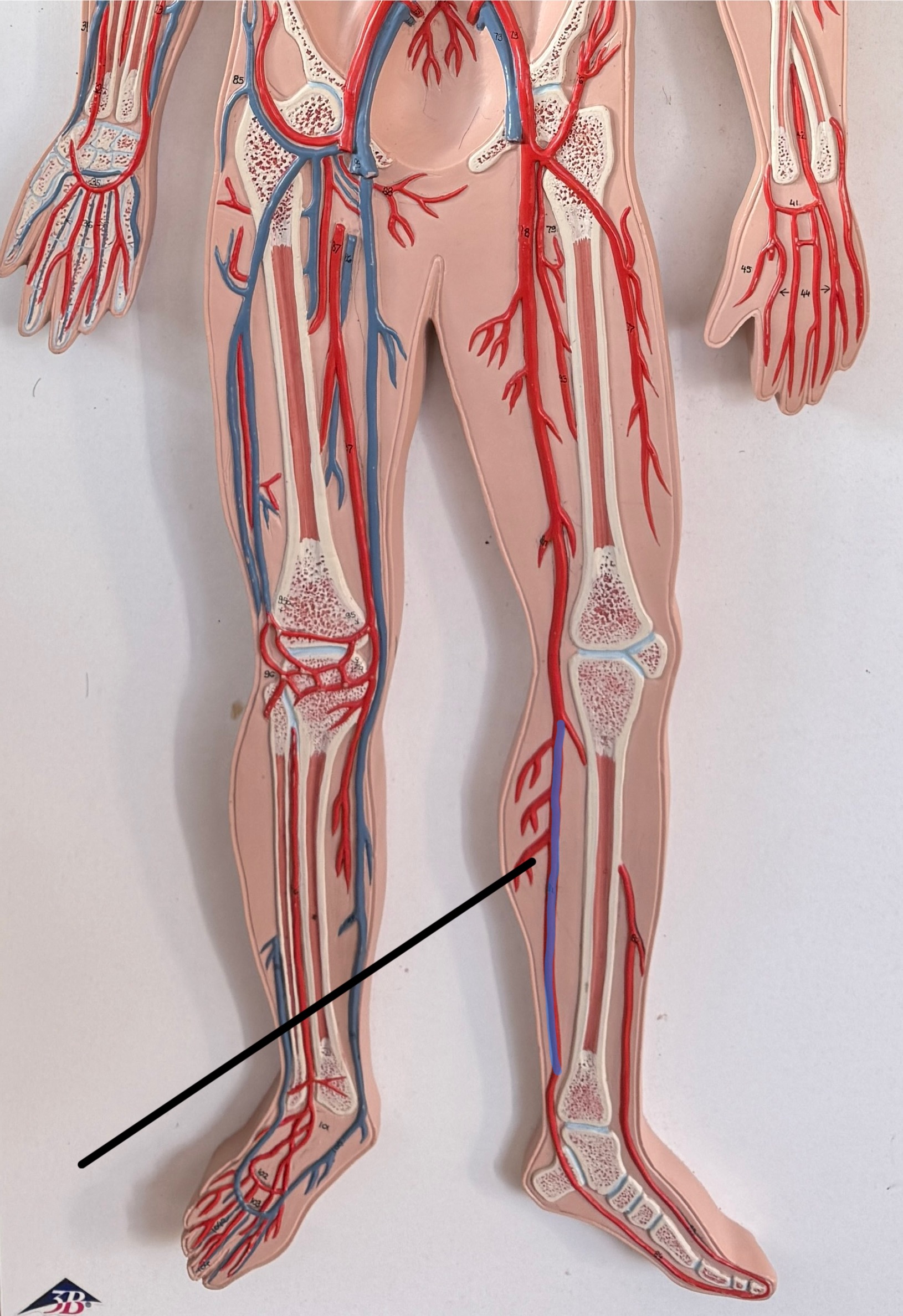 <p>Name this artery.</p>