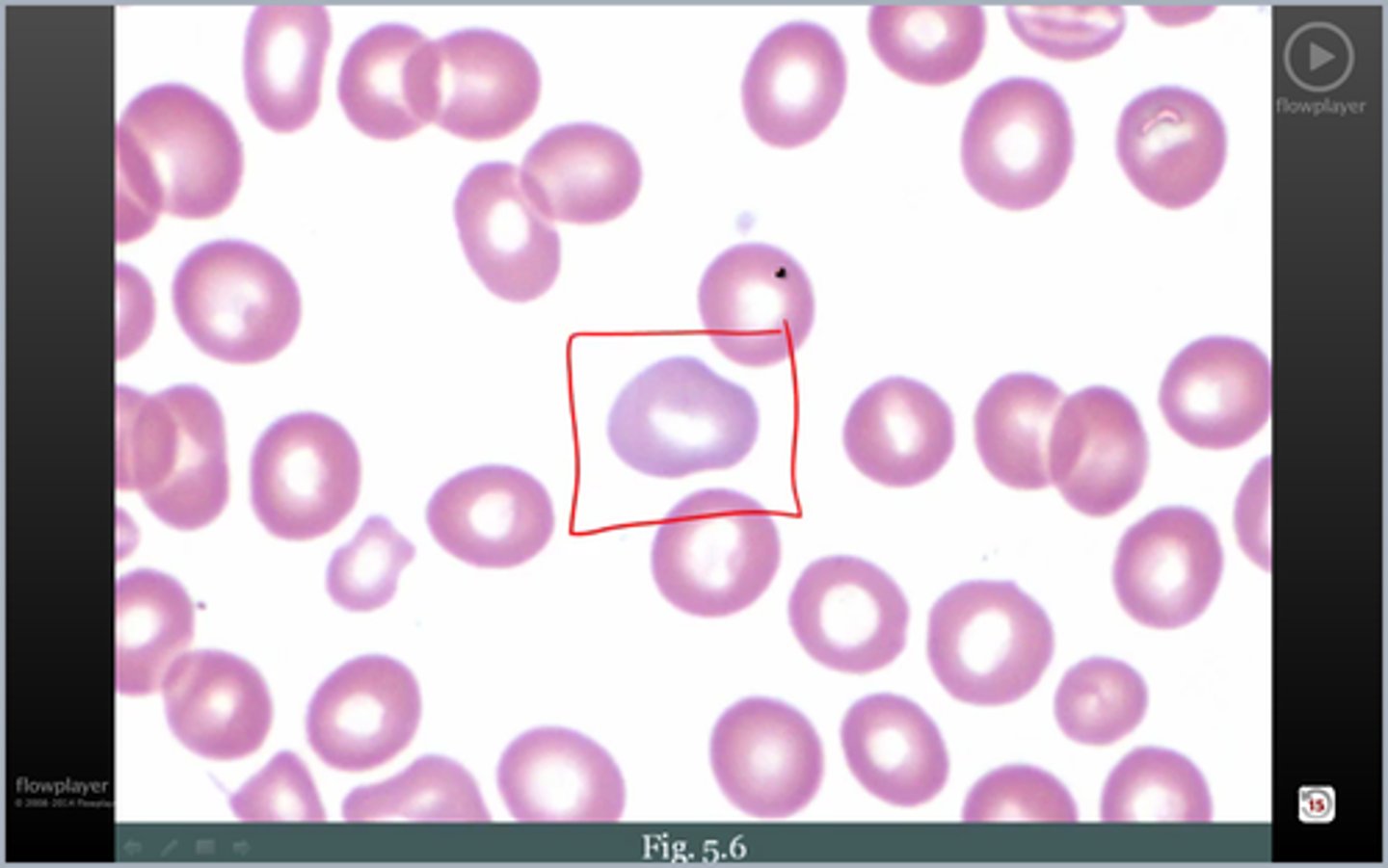 <p>what's weird abt this RBC?</p>