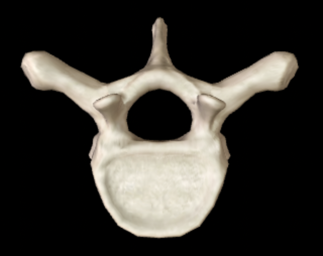 <p>Which section of the vertebral column does this bone belong to?</p>
