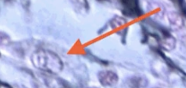 <p>What cell is the arrow pointing to?</p>