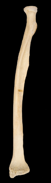 <p>What bone is this?</p><p>Left side or right side?</p><p>(Anterior view).</p>