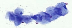 <p>Superficial cells</p>