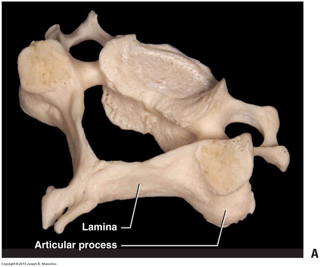 <ul><li><p>seven vertebrae that form the neck </p></li><li><p>have unique features like the <strong>foramen</strong> </p></li><li><p>the <strong>spinous process </strong> (flat part) looks circular with holes next to it </p></li></ul><p></p>