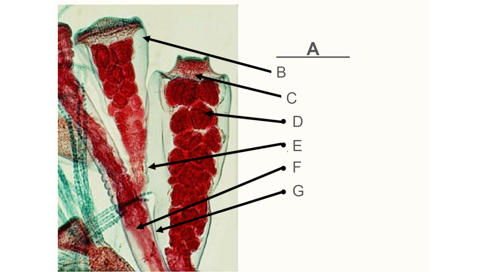 <p>What is A? (Part of an Obelia)</p>