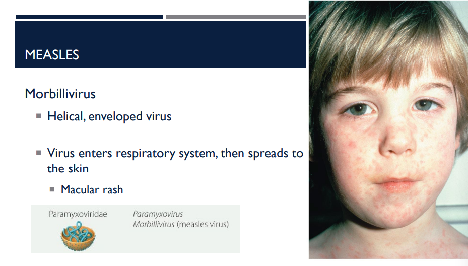 <p>This virus is a helical enveloped virus. The virus enters through the respiratory system, then spreads to the skin, resulting in a macular rash (maculopapular rash). What disease am I describing? What virus is it caused by?</p>
