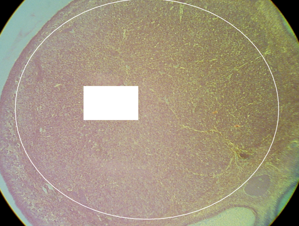 <p>What is the structure being shown in this image?</p><p>*Hint: The ovulated follicle is transformed rapidly into this new, highly vascularized, glandular structure.</p>