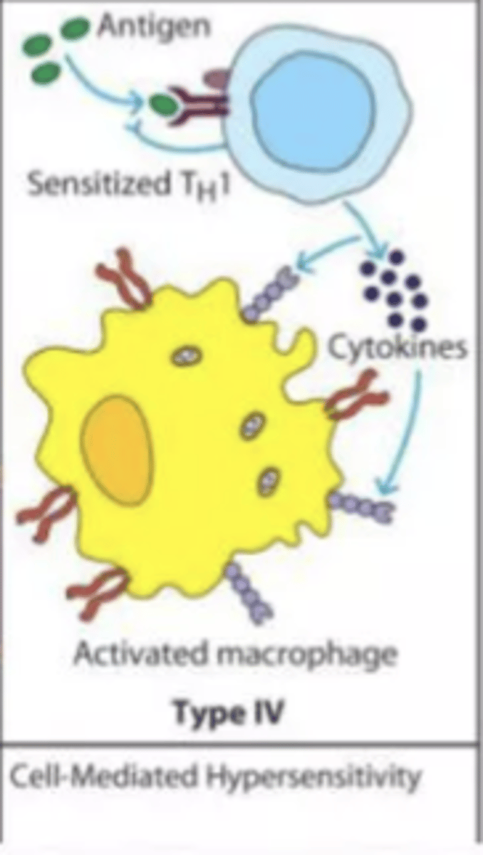 <p></p><p>MOA</p><p>- MHC presentation of drug molecules to t cells with cytokine and inflammatory mediator release</p><p>clinical manifestations</p><p>- allergic contact dermatitis</p><p>- drug rash</p><p>timing</p><p>- 2-7 days after continuous exposure</p>