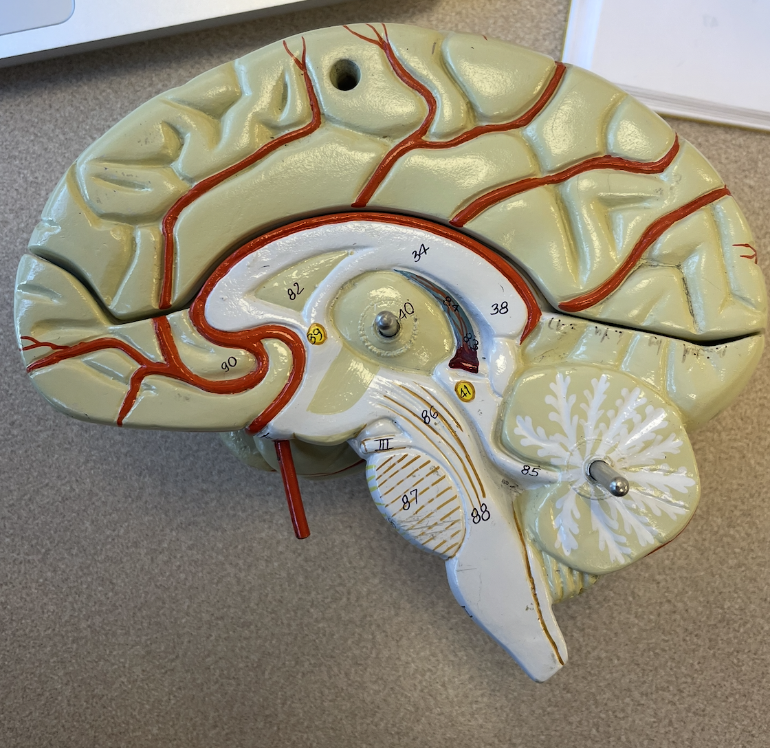 <p>What separates the open spaces in the middle of the brain 82</p>