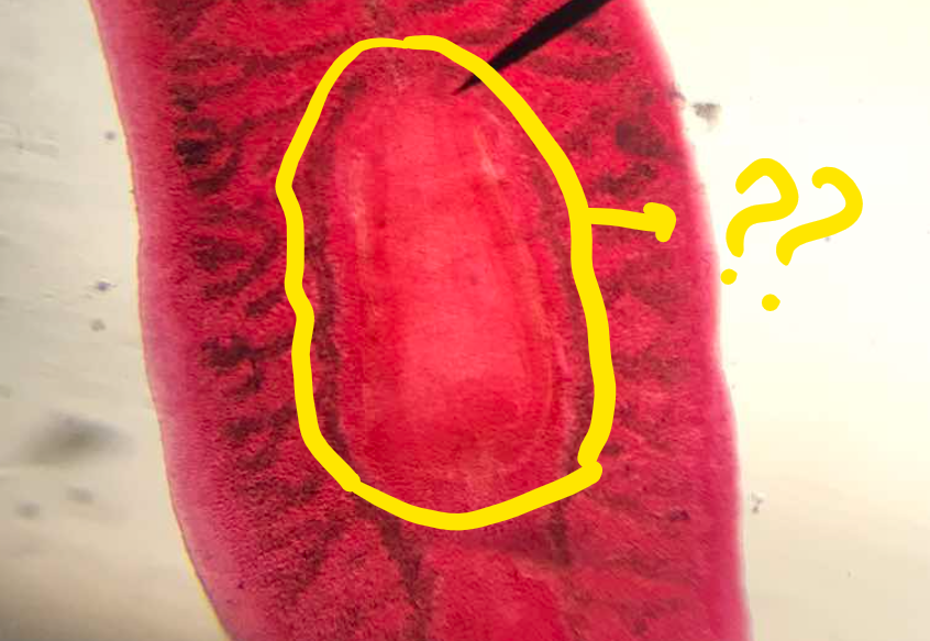 <p>part of Planaria; on the ventral side of the body directed posteriorly </p>