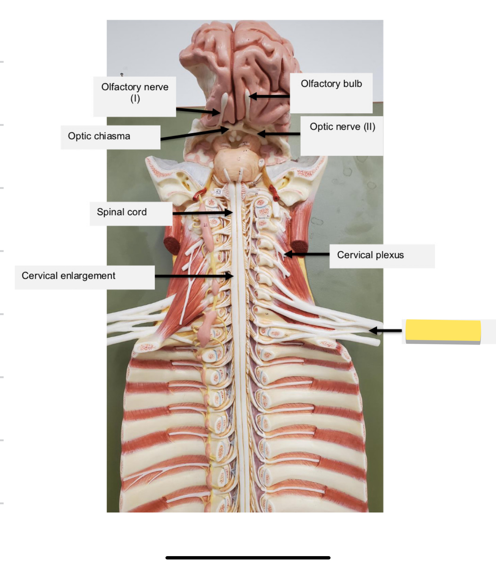 <p>Name this part</p>